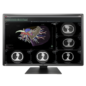 Medical Monitor