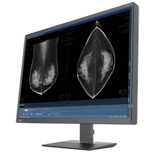 Medical display