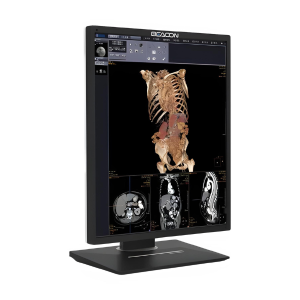 Medical display
